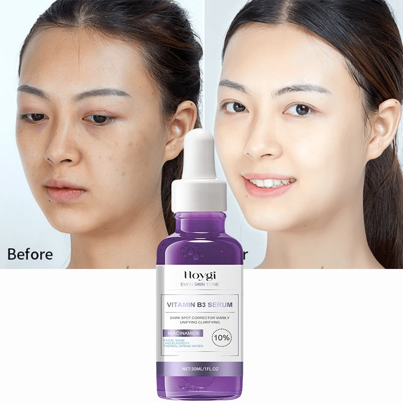 Антивозрастная сыворотка с витамином B3 Niacinamide отбеливание мелазма акне веснушек