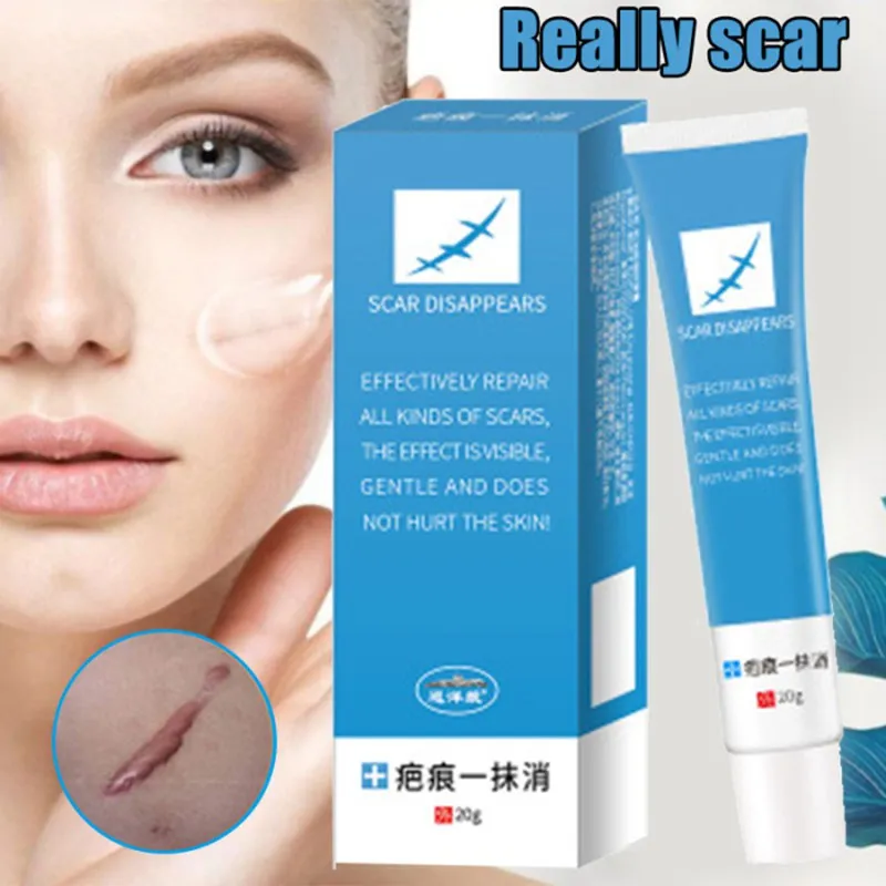 

20g Scar Removal Cream Gel Stretch Marks Remove Acne Spots Burn Surgical Scars Treatment Whitening Face Body Skin Care MH88
