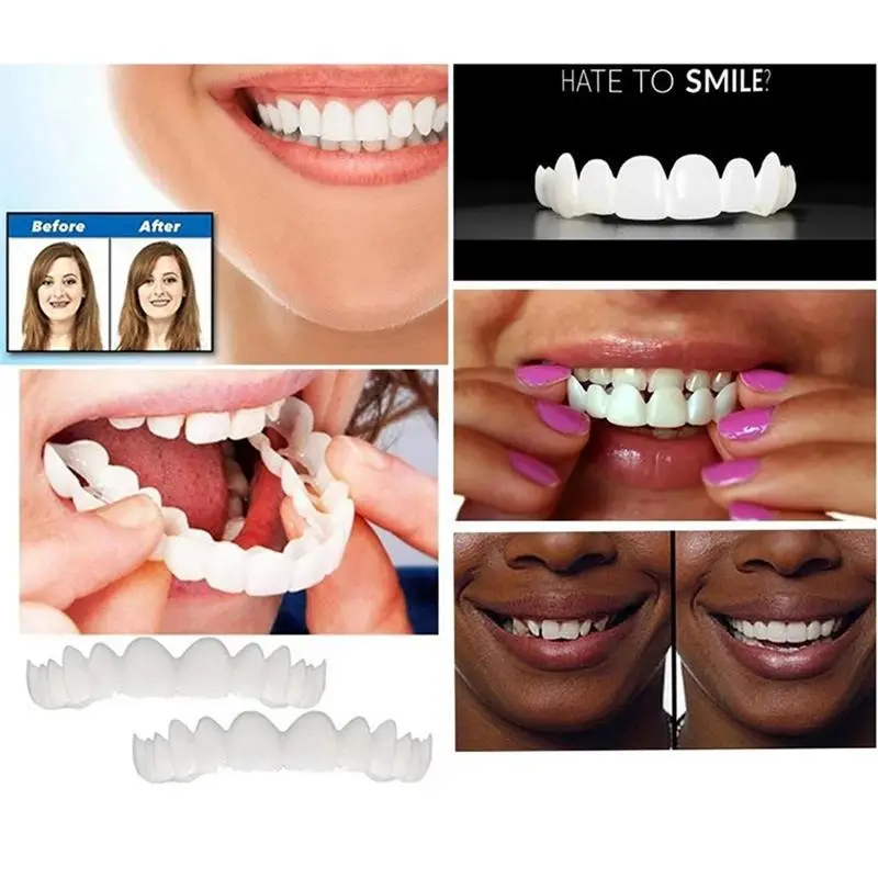 

Teeth Veneers Snap on Snap on Teeth Veneers Cover theImperfect Teeth Fake Tooth Instant Confidence Smile Temporary Teeth