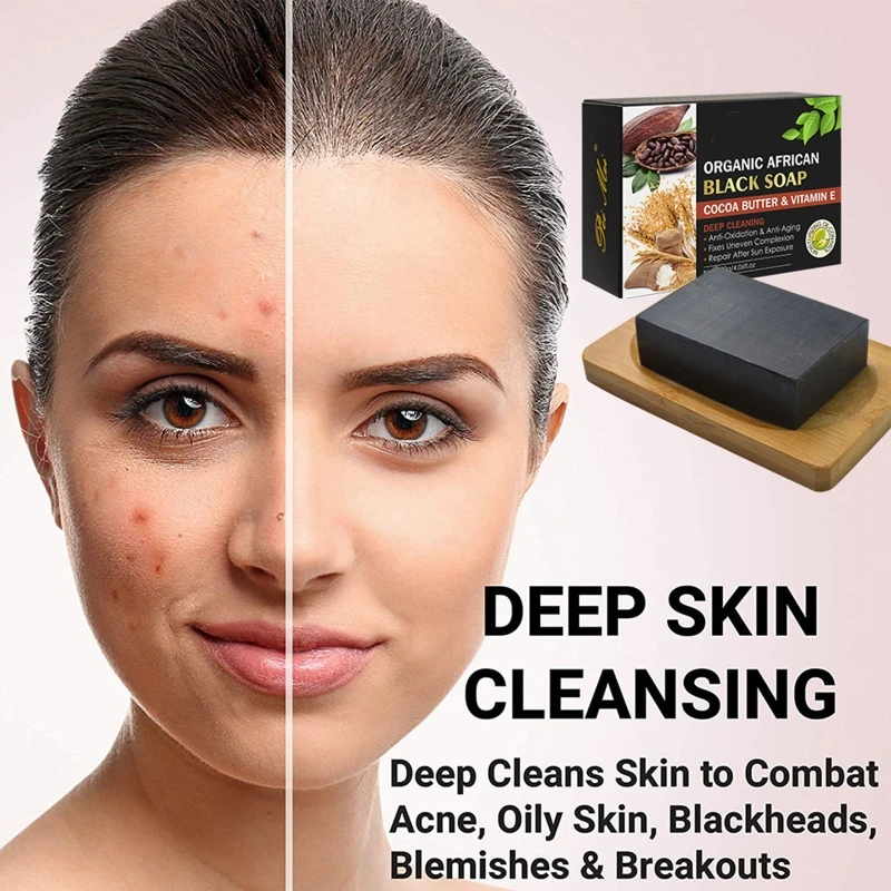 

Cleansing Soap Remove Dullness Skin Care Daily Essentials Face Soaps Bath Soaps 2022 New