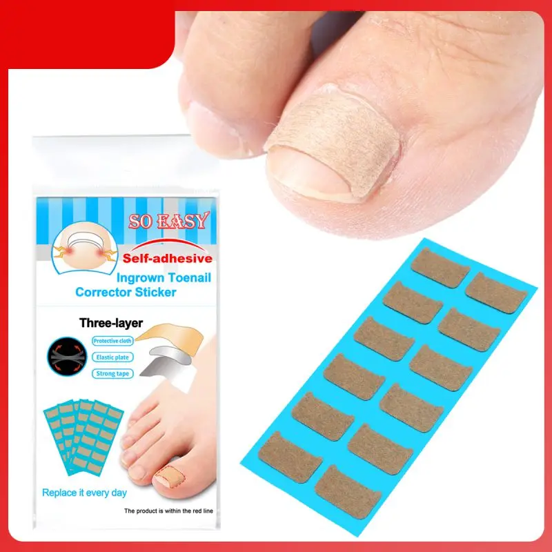 

Nail Ingrown Sticker Double-sided Glue Ingrown Nail Corrector Tool Paronychia Recover Corrector Pedicure Tools