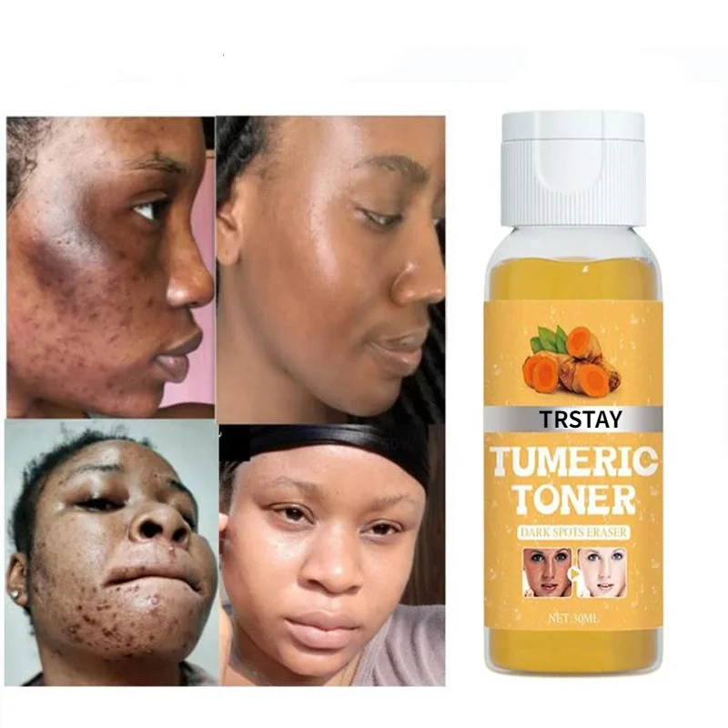 

Turmeric Lemon Skin Glow Face Serum Acne Dark Spot Whitening Black Patches Melasma Corrector Brightening Essential Oil Skin Care