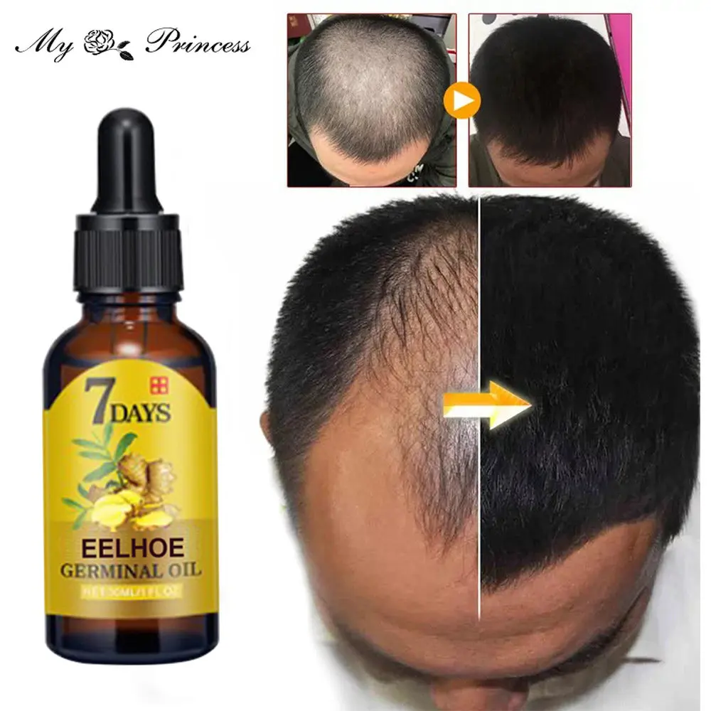 Продукты для роста волос имбирное быстрорастущее эфирное масло красота уход за