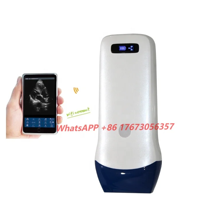 

Linear Probe 3D 4D Color Doppler Ultrasonido Machine Wireless Wifi Portable Ultrasound Scanner