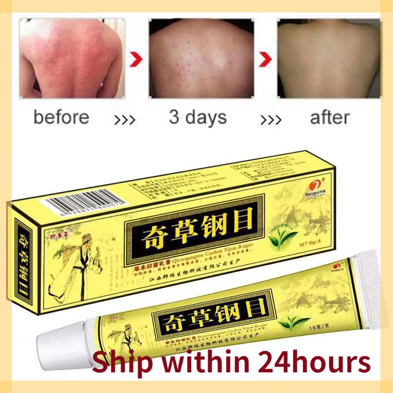 QICAOGANGMU 5/10pcs Skin Psoriasis Cream Psoriasis Treatment Ointment Dermatitis Eczematoid Eczema Cream Body Care Drop Shipping