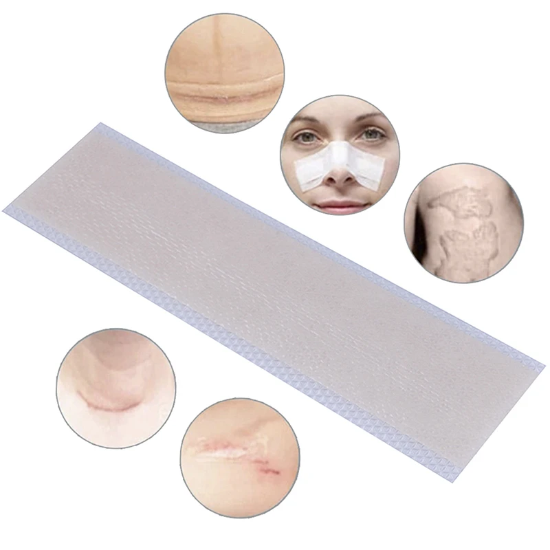 

New 7Styles Silicone Gel Sheet Scar Away Patch Removal Wound Marks Cesarean Keloid Skin Scars Therapy Treatment