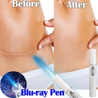soft scar remover acne laser pen blue light therapy portable wrinkle removal machine varicose veins treatment massage relax