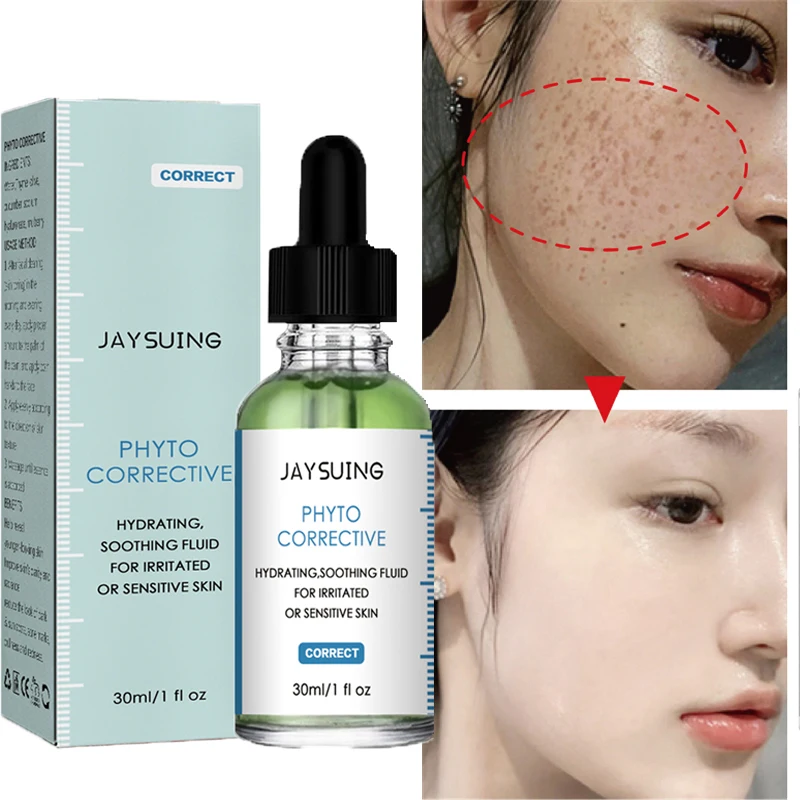 Effective Whitening Freckle Serum Remove Dark Spots Acne Marks Essence Anti-Aging Fade Pigmentation Melasma Brighten Skin Care