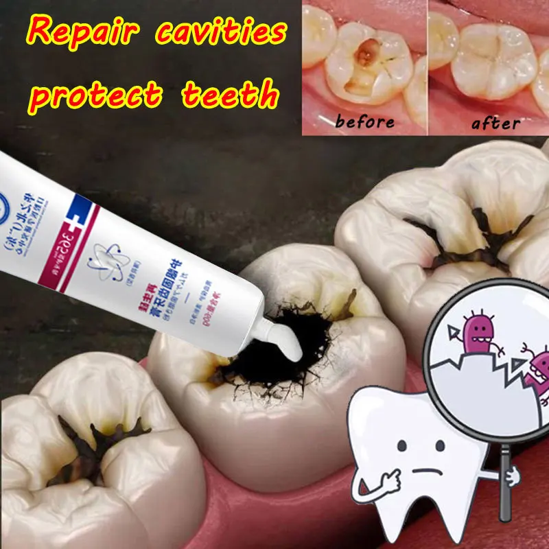 Teeth Whitening Toothpaste Repair Cavities Caries Teeth Teeth Whitening Removal Plaque Stains Eliminate Bad Breath Protect Gums