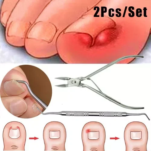 

Ingrown Toe Nail Correction Nippers Clipper Cutters Dead Skin Dirt Remover + Paronychia Podiatry Pedicure Care Tool