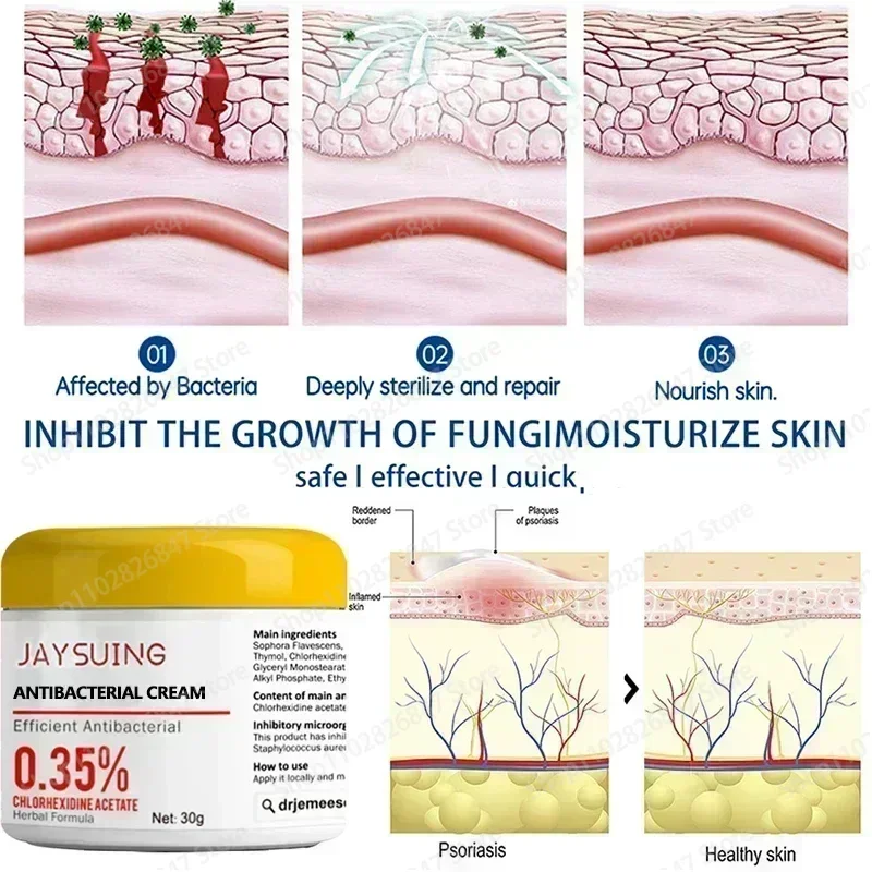 Антибактериальная мазь для лечения псориаза тела и бедра