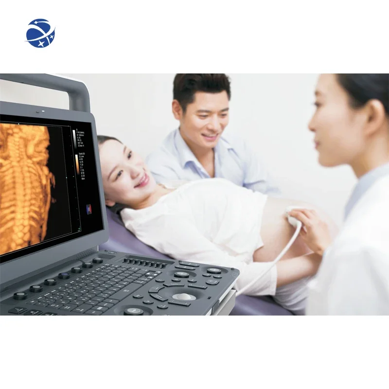 Портативный 2d 3d 4d эхокардиографический портативный цветной допплер-сканер для