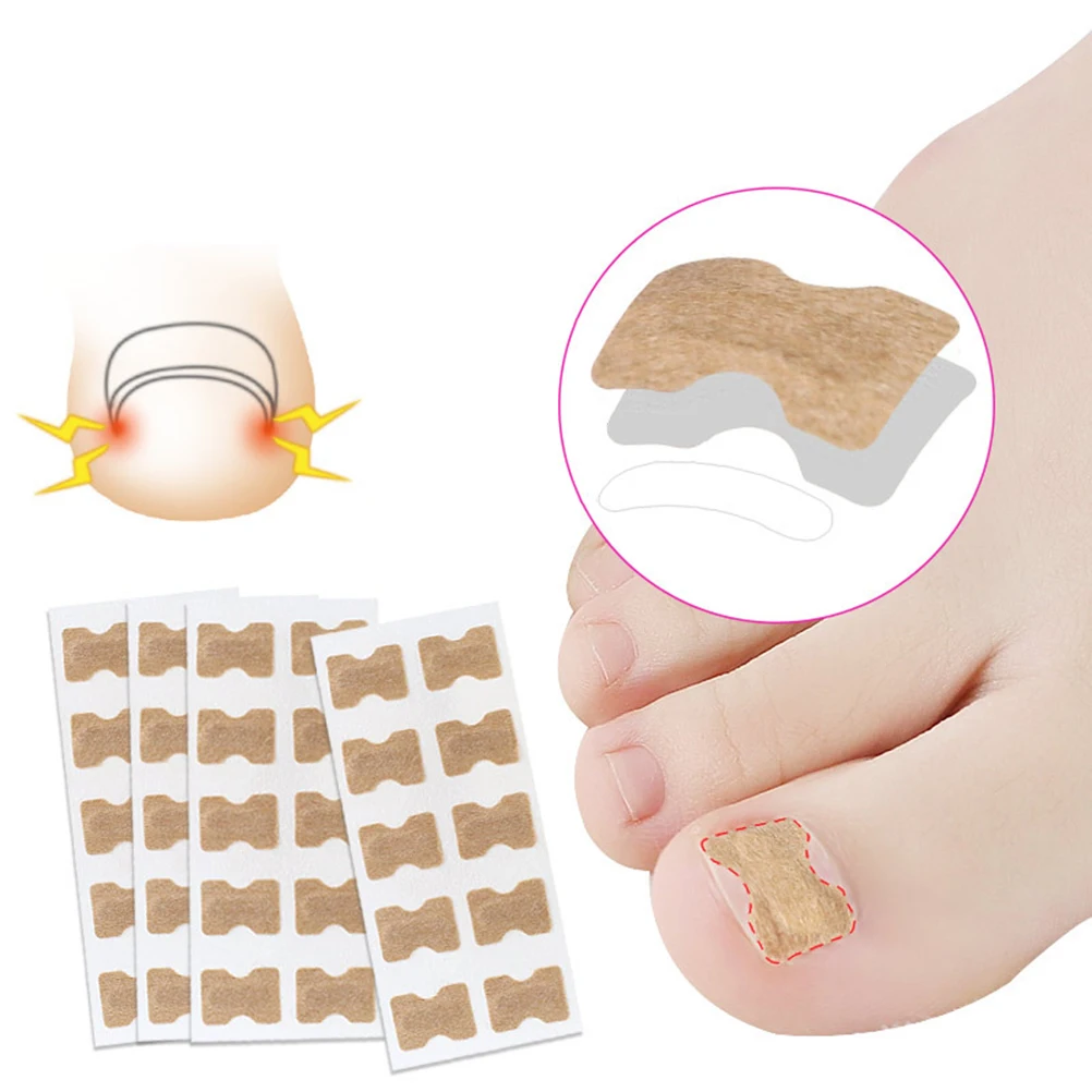 

2 Sheets Nail Correcting Stickers Toenail Corrector Ingrowing Toenail Patches Nail Groove Treatment Supplies For Adults Students