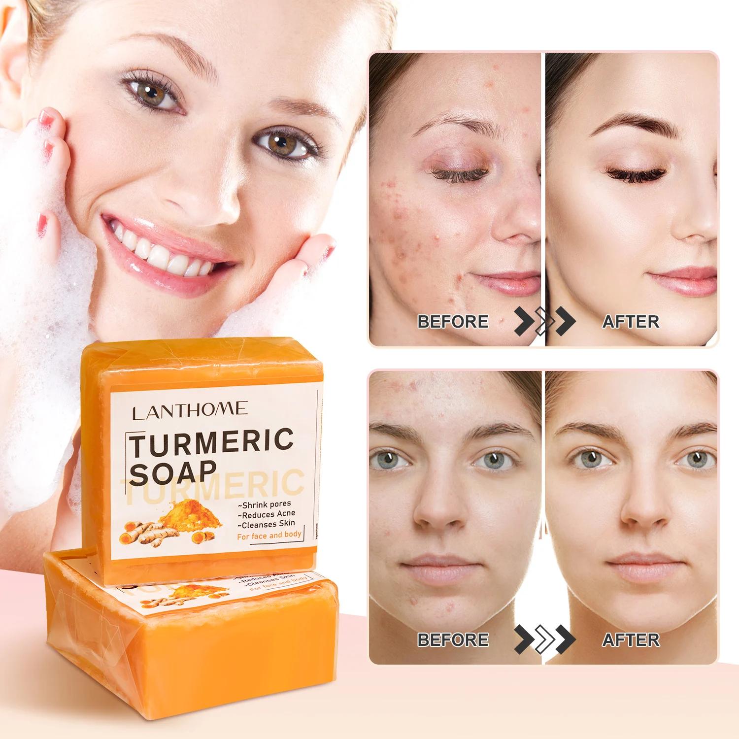 Мыло ручной работы с имбирем для освещения удаления прыщей темных пятен очищения