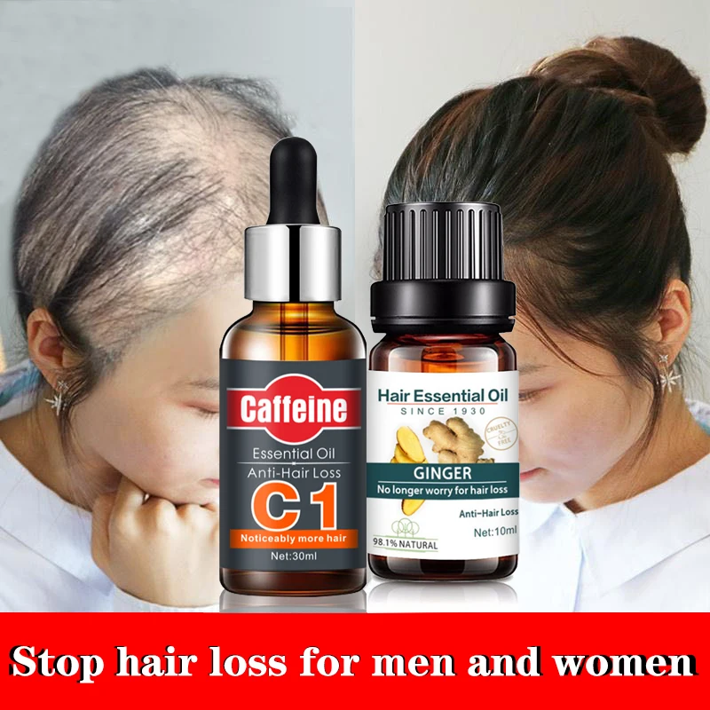 

Sdotter Magical Fast Powerful Hair Growth Essence Hair Loss Products Essential Oil Liquid Treatment Preventing Hair Loss Hair Ca