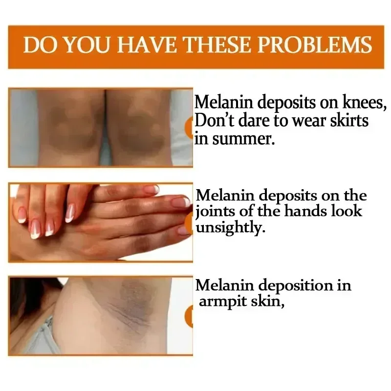 Отбеливающая сыворотка Dark knuckles для удаления локтей и подмышек Женская Сыворотка