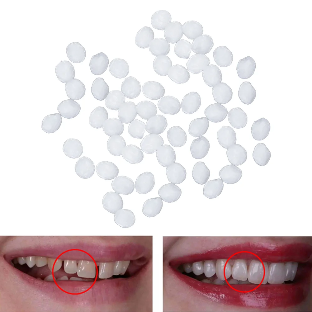 

Teeth Repair False Kit Fillingtemporary Granules Glue Moldablesets Tools Beautifier Covers Can You Eatveneerswomen Dentist Fix