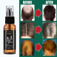hair growth essence spray fast hair growth liquid treatment scalp hair follicle anti hair loss natural beauty healthy hair care