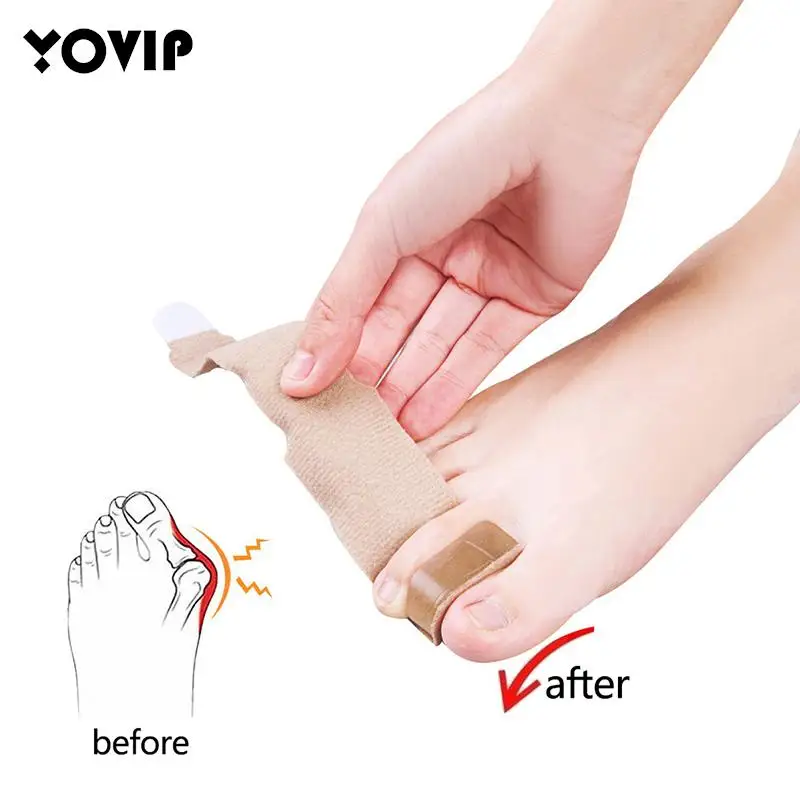 

1 шт., оболочка для большого пальца ноги, разделитель для большого пальца ноги