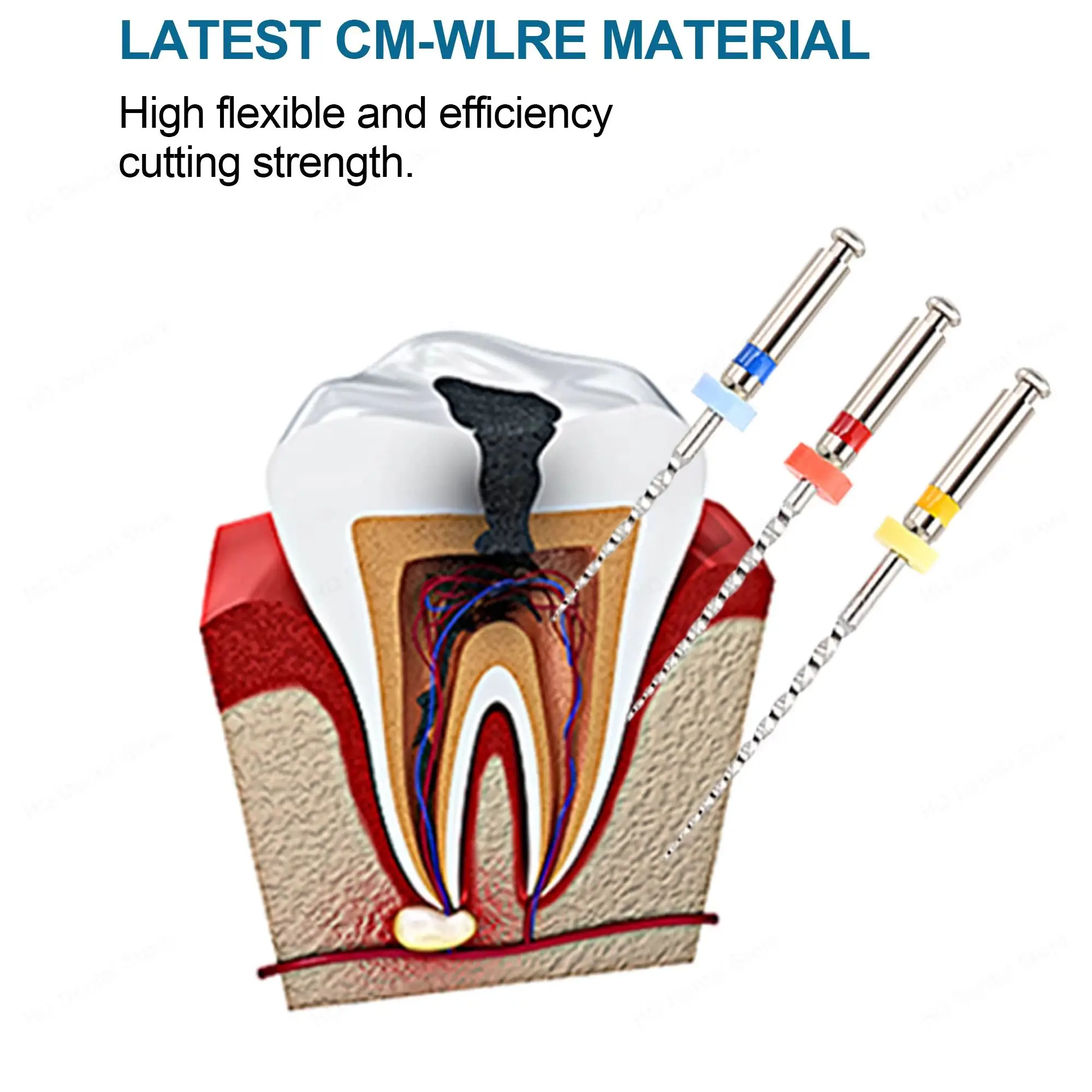 Фото Стоматологические файлы Twoendo Dental Niti Rotray для удаления пломбировочных материалов, трехдлиновые, инструмент для стоматологов, эндодонтические файлы №4