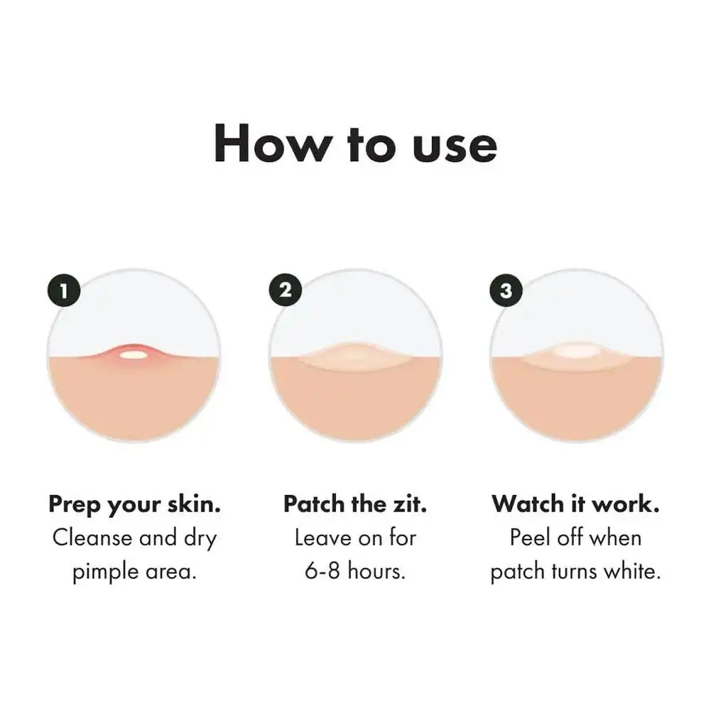 Лазерные Круглые патчи для прыщиков красочные Гидроколлоидные милые Zit наклейка