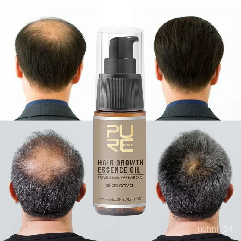 

[SPECIAL OFFER]PURC Hair Growth Spray Serum Anti Hair Loss Product Fast Grow Prevent Hair Dry Frizzy Damaged Thinning