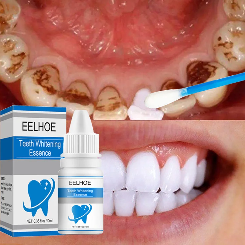 

Teeth Whitening Essence Remove Plaque Stains Serum Fresh Breath Oral Hygiene Against Dental Caries Dental Tooth Cleaning Tools