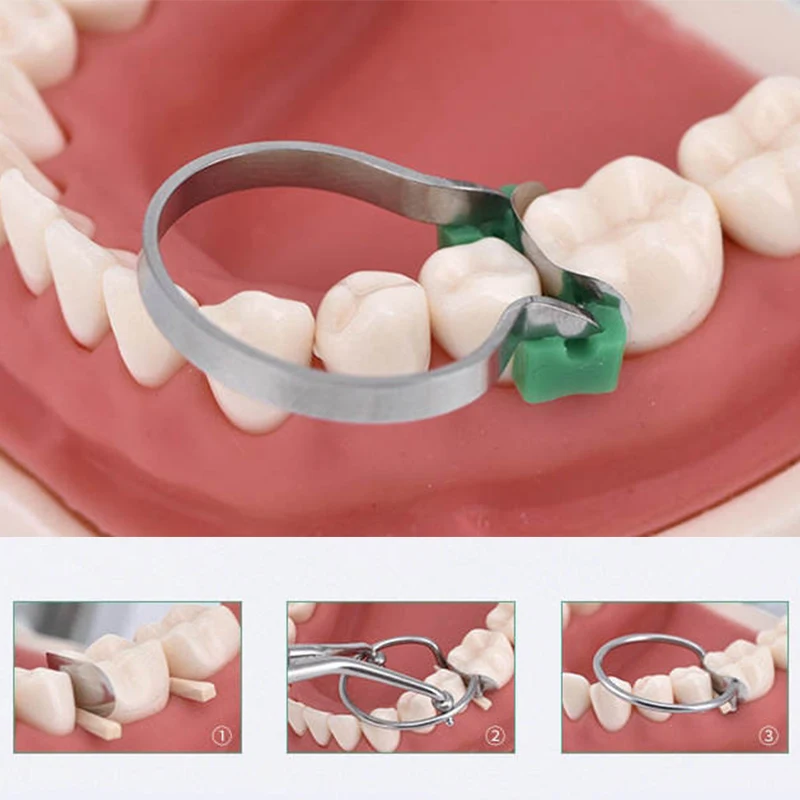 TJDent 36-500 шт. стоматологические секционные контурные матричные ленты клинья зажим