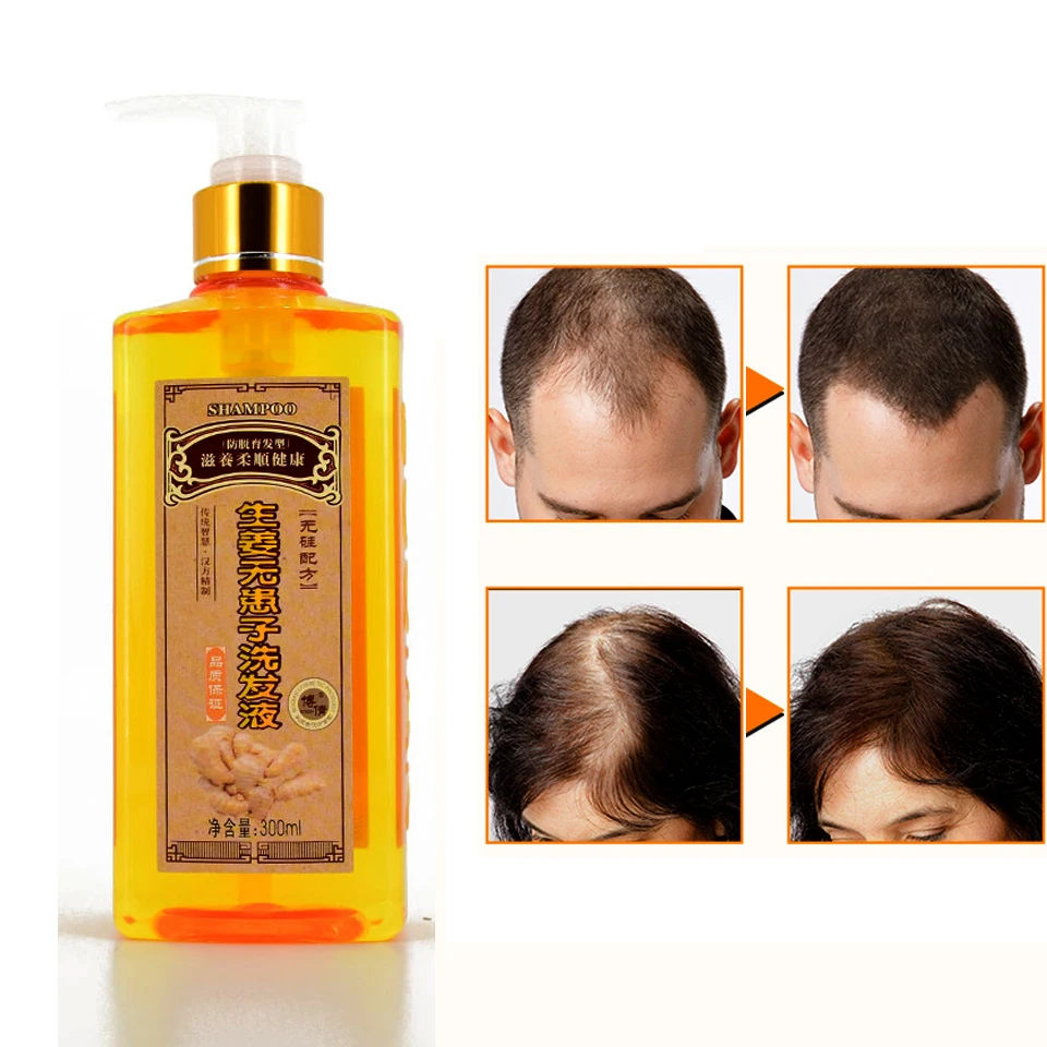 1 pcs Genuine Professional Hair ginger Shampoo Hair regrowth Dense Fast Thicker Shampoo Anti Hair Loss Product free shipping
