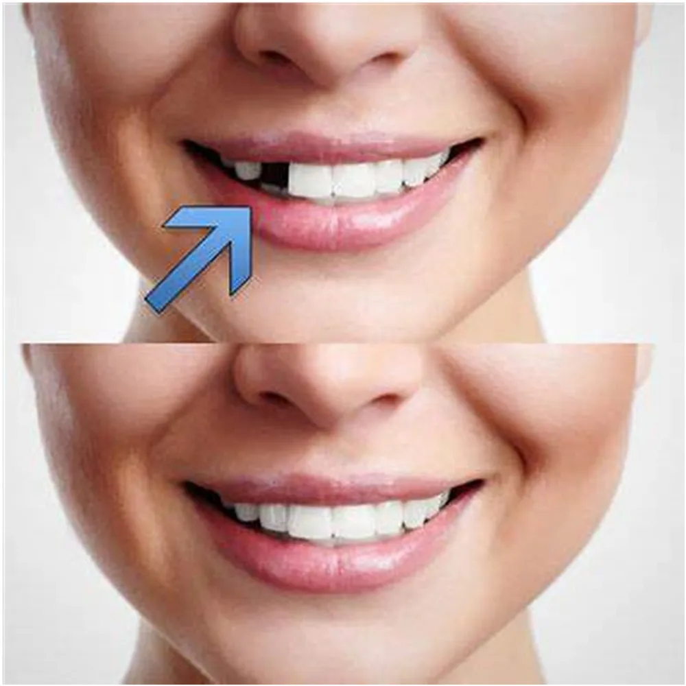 Набор для ремонта зубов SowSmile стоматологическая имитация полости рта 3-го