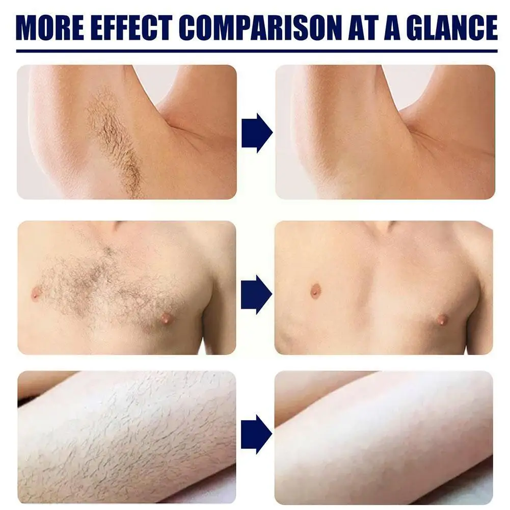 

1 Pc Hair Removal Cream Painless Hair Remover Armpit Legs Arms Skin Care Body Care Depilatory Cream 40g For Men Women U0r6