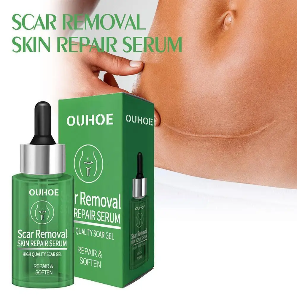 

Scar Removal Serum Remove Acne Spots Treatment Stretch Care Beauty Marks Smooth Moisturizing Scar Surgical Burn Whitening S P2Q8
