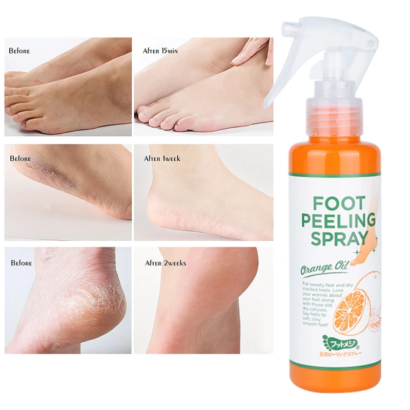 

Footmedi Foot Peeling Spray Removal Callus Dead Skin Pedicure Exfoliating Effective Anti Crack Whiten Moisturizing Feet Care