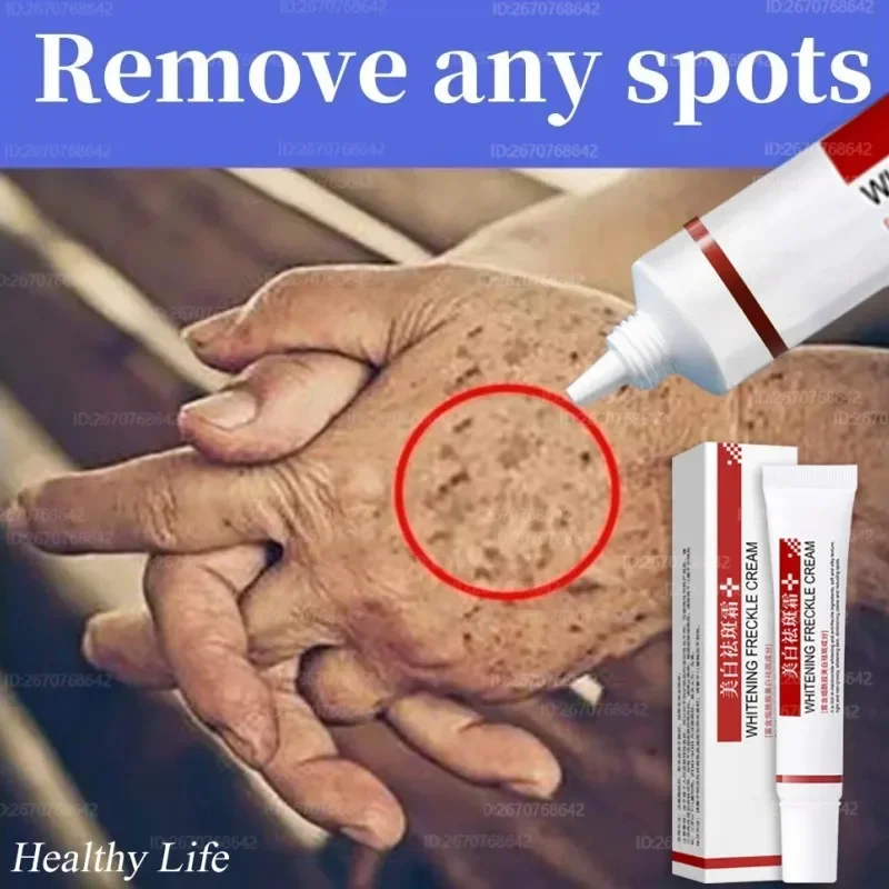 Крем для лица мелазма Осветляющий темную кожу эмульсия меланин крем тусклой кожи