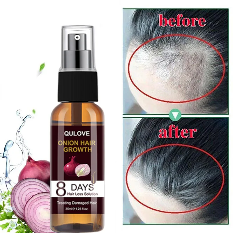 Essential Oil Improve Alopecia Hair Loss Treatment