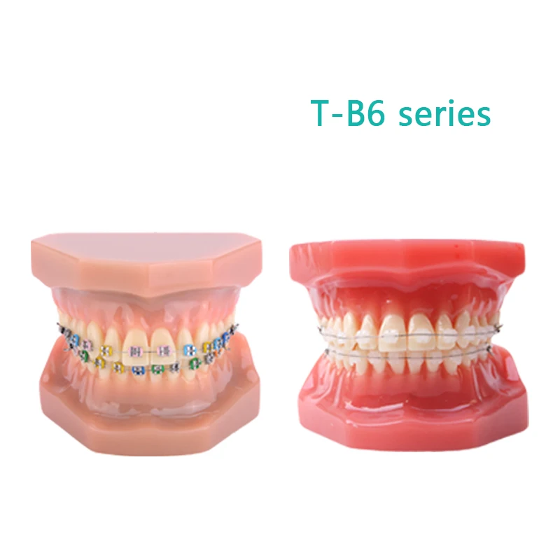 

Ortho Ceramic Bracket Model Dental Metal and Ceramic Model Teaching Study Demonstration Tool Model Dental Instruement