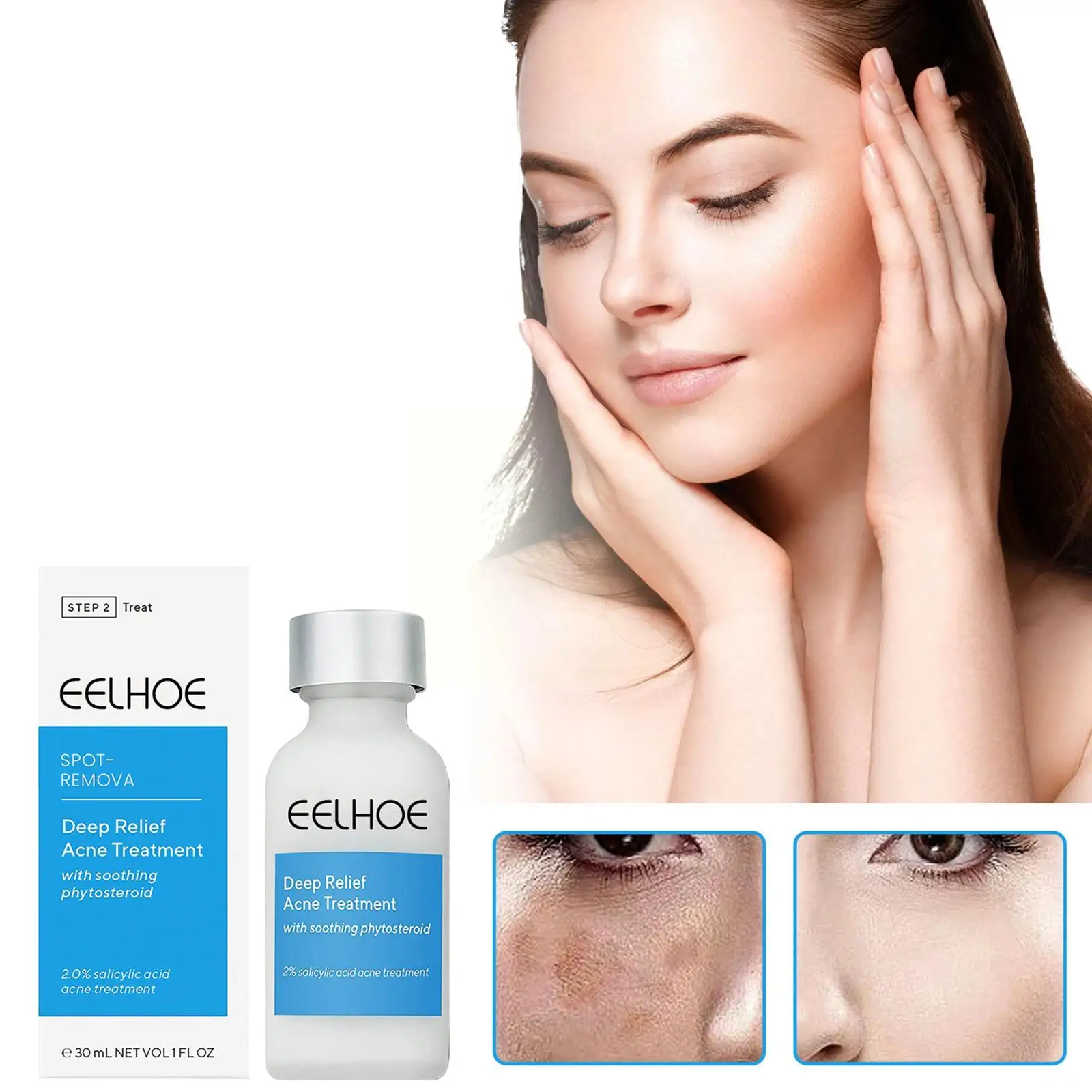 лосьон от прыщей clean clear. лосьон эффективный. мазь псориаз дайвонекс. средство от псориаза элоком лосьон. Clean clear лосьон для лица от прыщей.