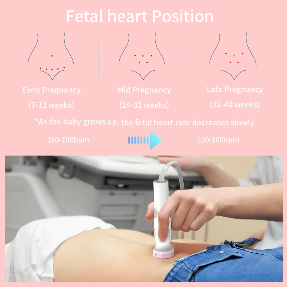 Fetal Heartbeat Detector Baby Care Household Portable for Pregnant Fetal Pulse Meter No Radiation Stethoscope