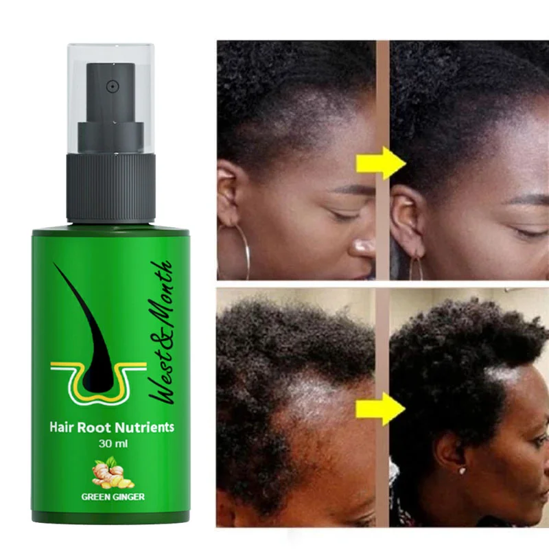 

Имбирное средство для лечения выпадения волос, эфирные масла, спрей для роста волос, предотвращение высыхания волос, истончение и восстанов...