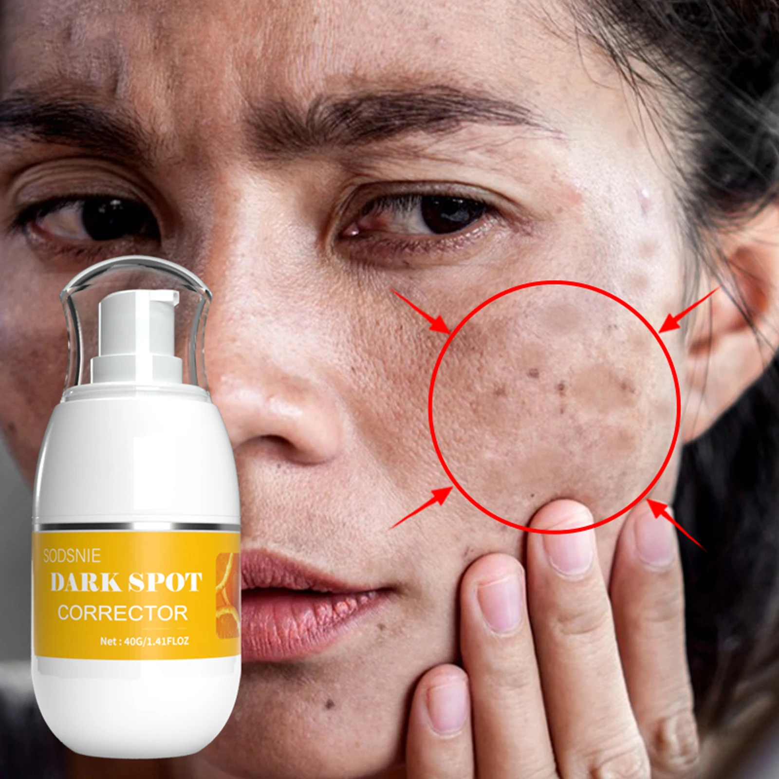 

Dark Spot Corrector Cream Whitening Freckle Cream Powerful Effectively Remove Melasma Age Spots Melanin Lightening Skin Care 40g