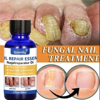 antifungal nail treatment serum hand foot care repair gel anti infection paronychia 50ml
