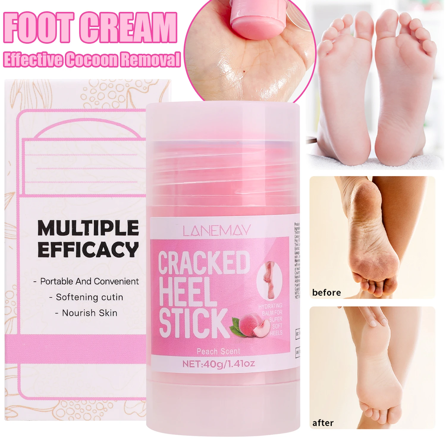 40g Urea Foot Cream Dry Cracked Feet Heel Gentle Exfoliation Softening Skin Ultra-Hydrating Hand Care Stick Protuct