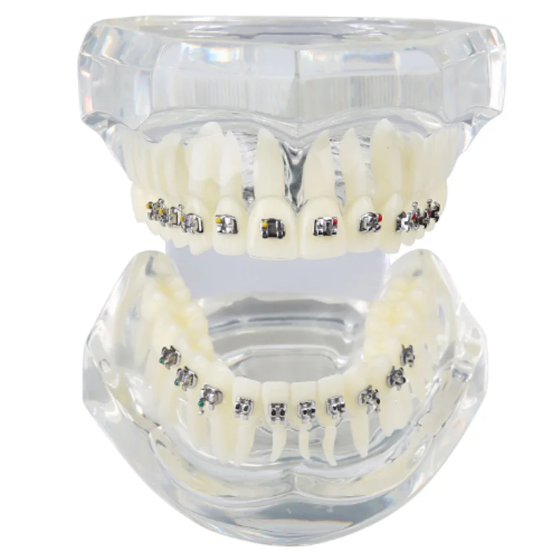 

Orthodontic Dental Typodont Adult Teeth Model with Metal Bracket M3001 Demonstration Practice Study Education Dental Model
