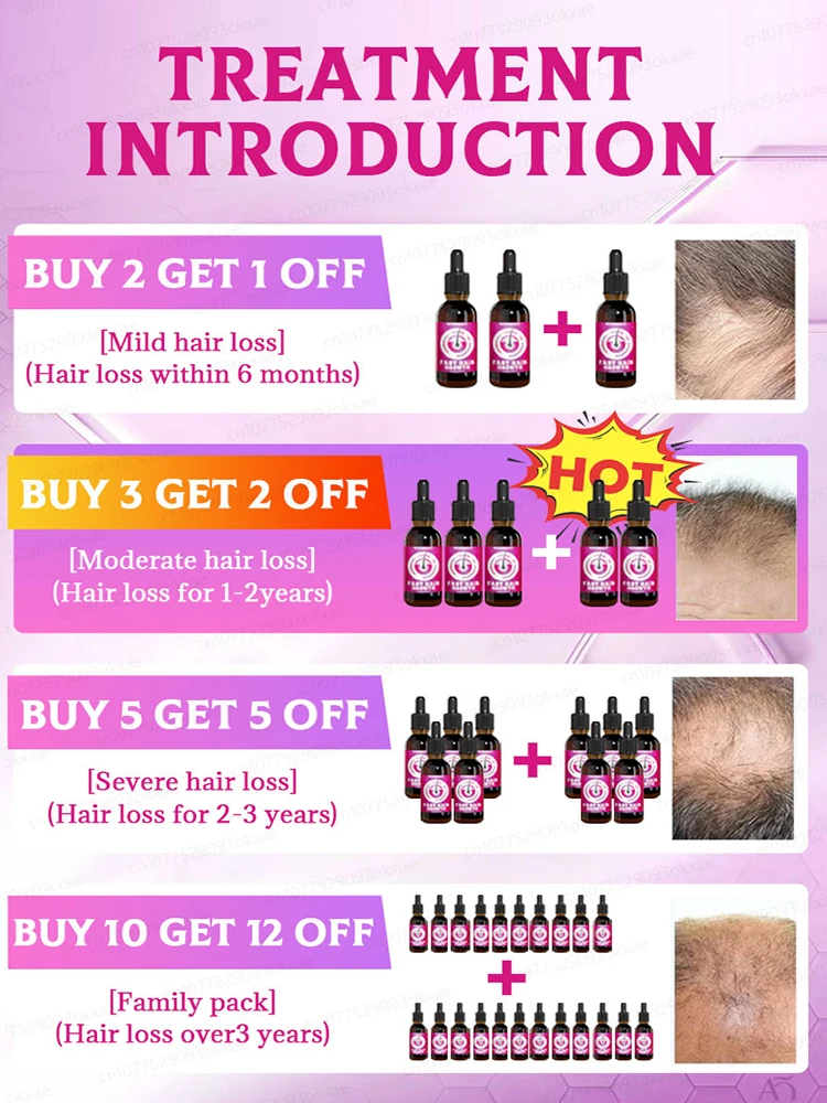 Массаж и расслабляет кожу головы для снятия стресса выпадения волос.