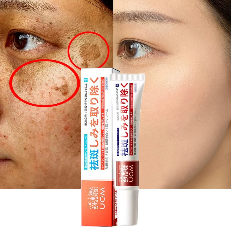 Effective Whitening Freckles Cream Remove Dark Spots Fade Melanin Pigmentation Improve Dullness Moisturizing Brighten Skin Care