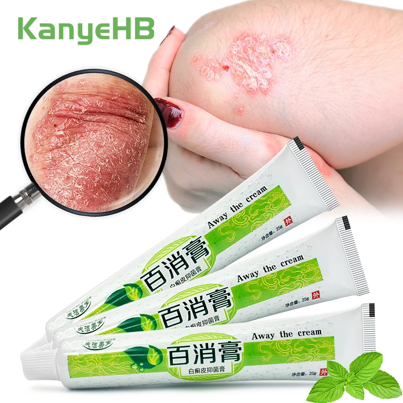 

3Pcs Psoriasis Cream Anti Fungal Infection Treat Dermatitis Eczematoid Eczema Tinea Pedis Anti-Itch Ointment Health Care A1302