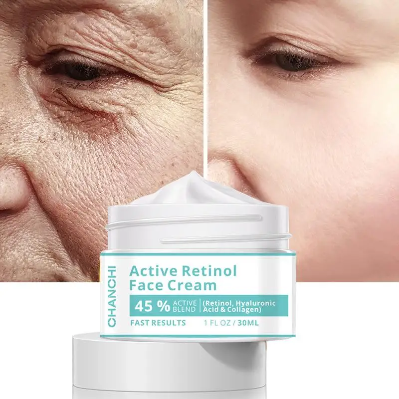 

Active Retinol Cream reduces wrinkles for younger looking skin