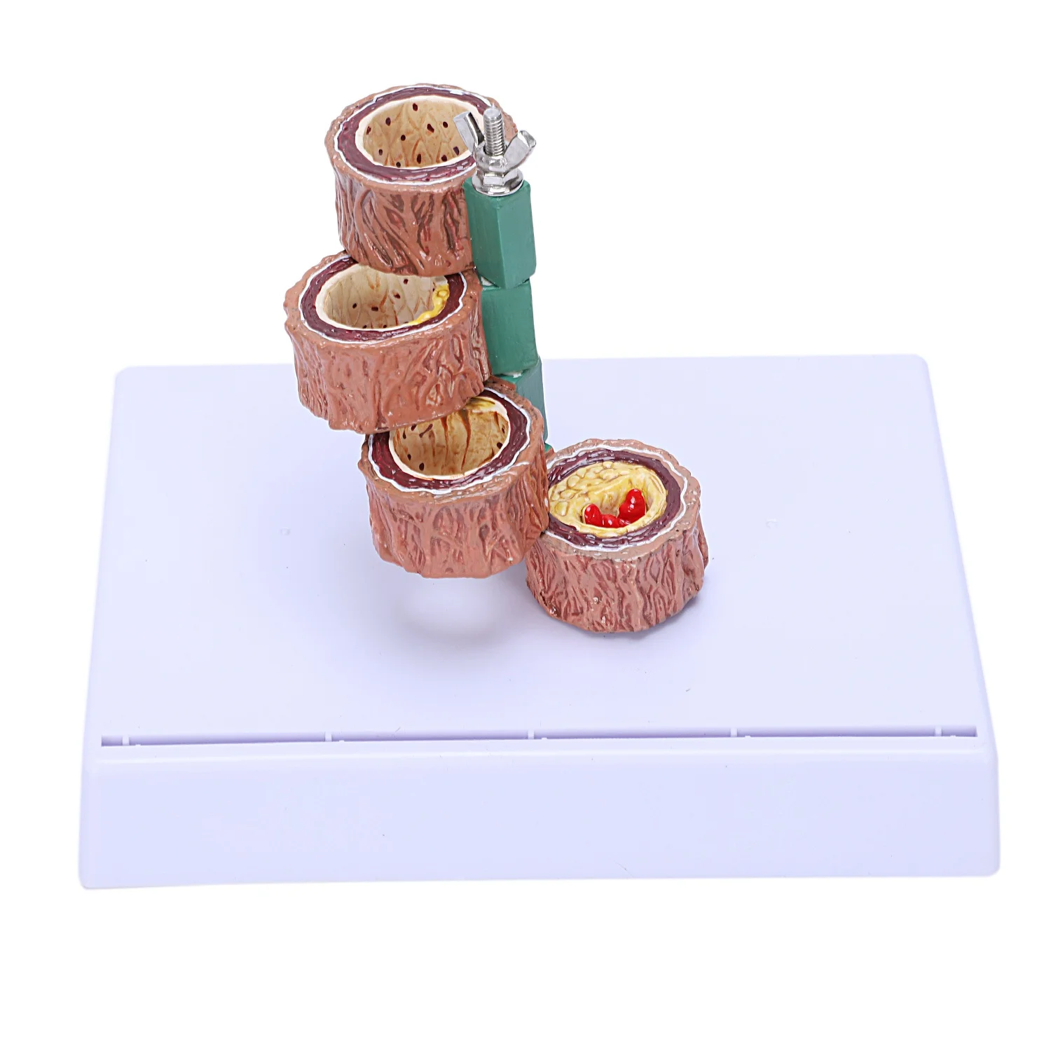 Модель тромбоза атеросклероза демонстрация сосудистых заболеваний модель