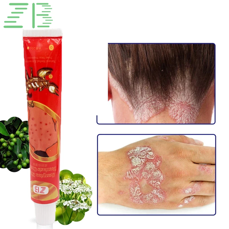 

1 шт., антибактериальная мазь для ухода за кожей при псориазе