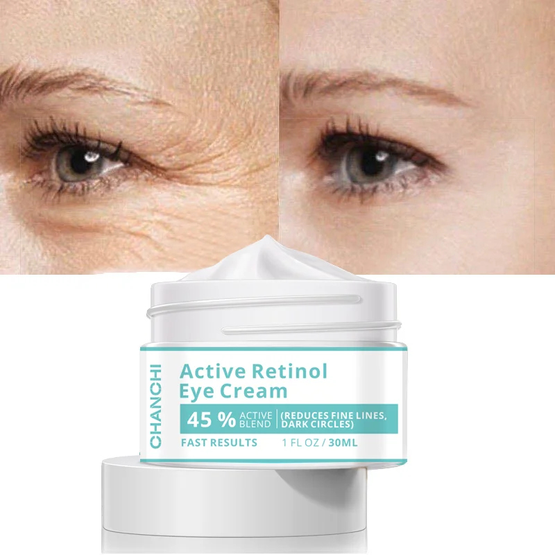 

Retinol Cream Remove Eye Bags Cream Anti Dark Circles Puffiness Eye Gel Fade Wrinkles Anti Aging Brighten Firming Skin Care 30g